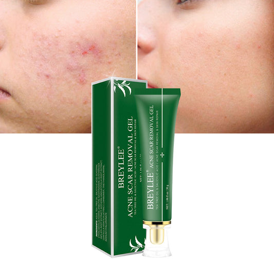 Acne Scar Removal Gel Tea Tree Qu Dou Printing