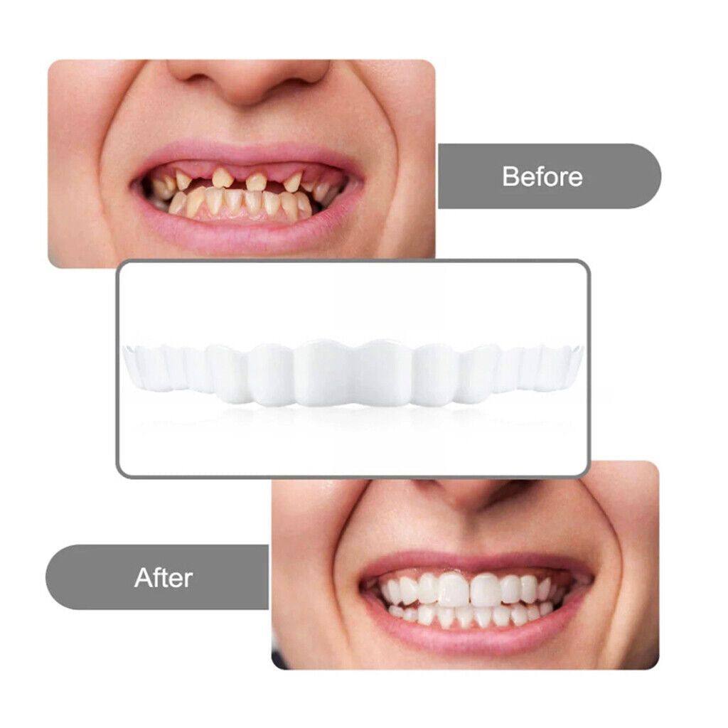 Cosmetic Denture Denture Denture False Teeth Artificial Teeth DE