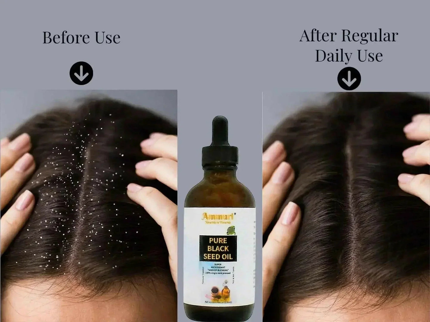 Pure Organic Black Seed Oil | Cold-Pressed Nigella Sativa for Skin, Hair & Wellness – Ammuri Beauty