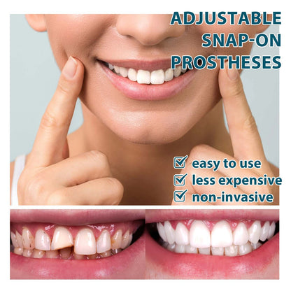 Adjustable Buckle Dentures